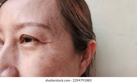 portrait the flabbiness and wrinkle, ptosis and flabby skin beside the eyelid, dull skin and dark spots on the cheek, freckles and blemish on the face of the woman, health care and beauty concept.