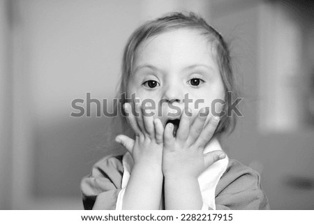 Portrait of a girl with Down syndrome. Black and white image. Close-up portrait of a child. The girl holds her hands near her face. Emotional photo.
