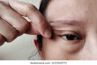 portrait the hand squeezing adipose hanging skin on the eyelid, flabbiness skin of the beside on the face of woman, concept health care.