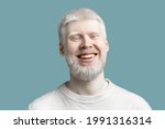 Portrait of happy bearded albino man with pale skin and white hair wearing t-shirt, posing and smiling to camera on turquoise studio background. Abnormal deviations, unusual appearance