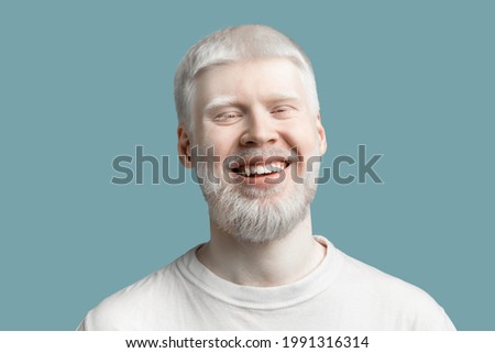 Portrait of happy bearded albino man with pale skin and white hair wearing t-shirt, posing and smiling to camera on turquoise studio background. Abnormal deviations, unusual appearance