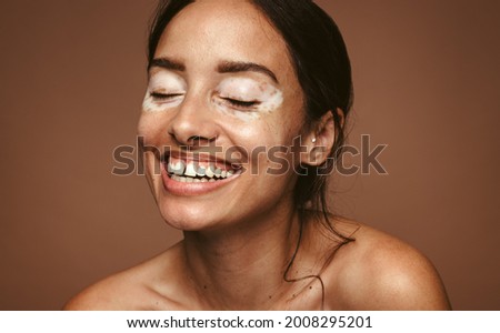 Portrait of happy woman with vitiligo against brown background. Close up of woman with skin disorder smiling with closed eyes.