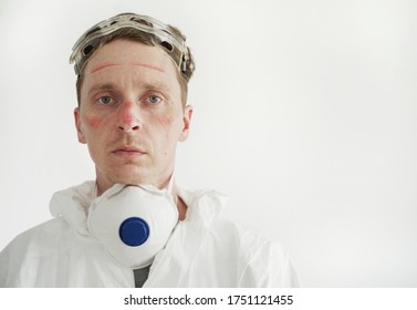 Portrait Of Male Nurse. Face Bruised And  Rubbed Raw By Face Mask.
