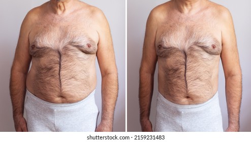 Portrait Of A Mature Man Before And After Weight Loss On White Background. Body Shape Was Altered During Retouching