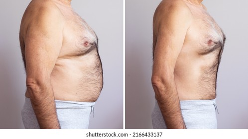 Portrait Of A Mature Man Before And After Weight Loss On White Background. Body Shape Was Altered During Retouching