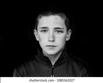 Portrait Of Middle School Age Boy With Bruises All Over His Face. Black Eye And Bruised Cheek And Forehead. 