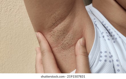 Portrait Showing The Fingers Holding The Flabbiness And Wrinkled Skin Under Arm, Problem Armpit Long Hair Underarm Of The Woman, Concept Health Care.