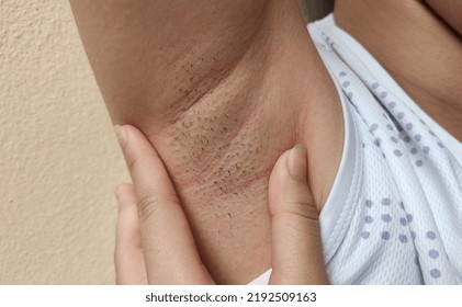 Portrait Showing The Fingers Holding The Flabbiness And Wrinkled Skin Under Arm, Problem Armpit Long Hair Underarm Of The Woman, Concept Health Care.