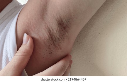 Portrait Showing The Fingers Holding The Flabbiness And Wrinkled Skin Under Arm, Problem Armpit Long Hair Underarm Of The Woman, Concept Health Care.