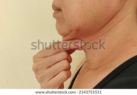 portrait showing the fingers squeezing flabbiness adipose skin under the neck, problem cellulite and double layered under the chin of the woman, concept health care.
