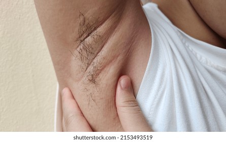 portrait showing the fingers touching armpit hair, problem wrinkles on the armpit of the woman, concept health care.