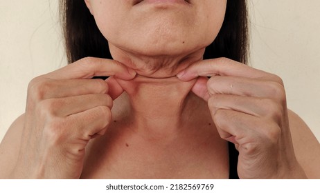 portrait showing the flabbiness adipose sagging skin under the neck, problem wrinkles Flabby and cellulite under the chin of the woman, concept health care. - Shutterstock ID 2182569769