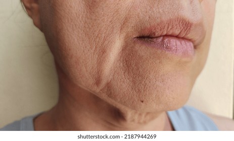 portrait showing the flabbiness adipose sagging skin on the face, cellulite under the eyes, blemishes and dark spots, problem wrinkled and flabby skin of the Middle-aged woman, concept health care. - Shutterstock ID 2187944269