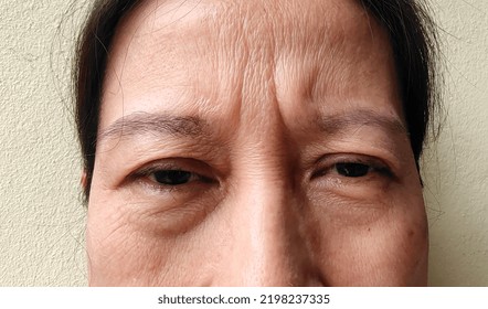 portrait showing the flabbiness adipose sagging skin, Flabby and dark spots on the face, cellulite under the eyes, forehead lines on the face, problem wrinkled and aged of the Middle-aged woman. - Shutterstock ID 2198237335