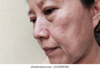 portrait showing the flabbiness skin, problem wrinkled and rough skin on the face of woman, concept health care. - Shutterstock ID 2134305581