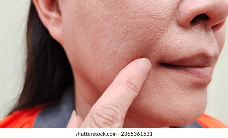 portrait showing the flabbiness and wrinkle beside the mouth dark spots and blemish on the face of the woman, health care and beauty concept. - Shutterstock ID 2365361531