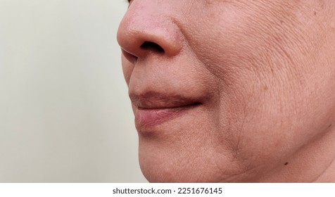 portrait showing the flabbiness and wrinkle, smile lines beside the mouth, wrinkles and dullness of the facial, dark spots and blemish on the face of the woman, health care and beauty concept.