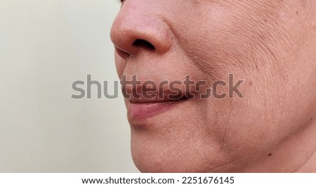 portrait showing the flabbiness and wrinkle, smile lines beside the mouth, wrinkles and dullness of the facial, dark spots and blemish on the face of the woman, health care and beauty concept. Foto d'archivio © 
