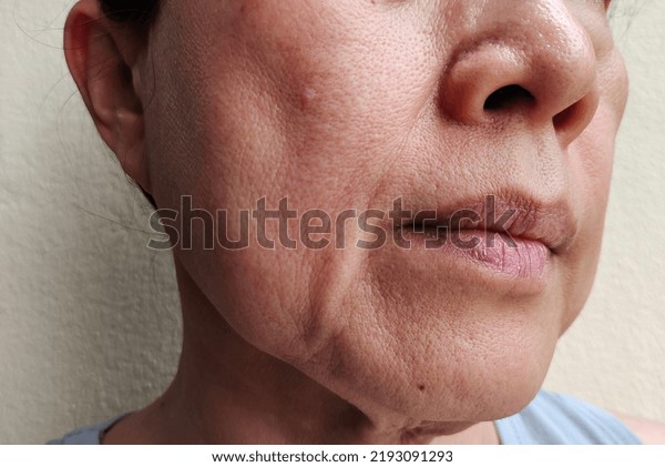 portrait showing the flabbiness and wrinkles corner\
of mouth, Dullness and dark spots on the face, problem Flabby and\
rough skin, freckles and aged skin of Middle-aged woman, concept\
health care.