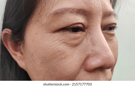 portrait showing the flabbiness and wrinkles skin under the eyes, problem flabby skin on the face of the woman, concept health care. - Shutterstock ID 2157177703