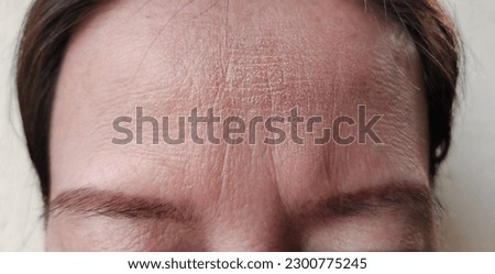 portrait showing the wrinkle and lines on the forehead, Flabbiness and Flabby skin on the face, dryness skin and dark spots of Middle-aged woman, health care and beauty concept.