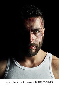 Portrait Of A Strong Man With A Beard, Face In Blood. He Looks At The Camera With Different Emotions. Blood And Sweat Dripping Down His Face. Fists Erased From Strikes