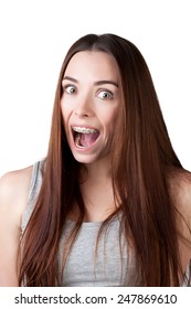 Portrait Surprised Woman Wearing Braces Stock Photo 247869610 ...