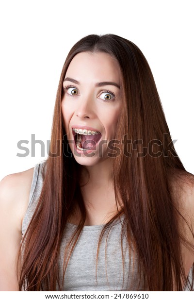 Portrait Surprised Woman Wearing Braces Stock Photo 247869610 ...