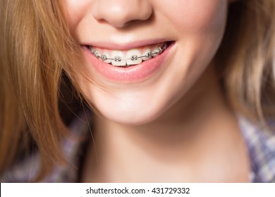 Portrait of teen girl showing dental braces. - Shutterstock ID 431729332