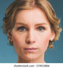 Portrait Of A Woman Before And After Botox. Young And Old Face.