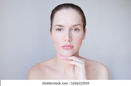 
Portrait Of A Woman With Facial Asymmetry And A Squeezed Upper Eyelid