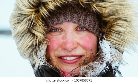 Portrait von Frauen mit gefrorenem Gesicht während der Schneeschuhaktivitäten im ländlichen Kanada