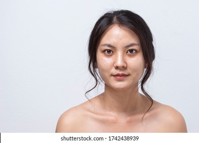 Portrait Of Women Before Facial Face Care, Asian Young Girl Face Skin Treatment. Fresh Skin, No Makeup.