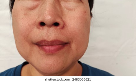 portrait the wrinkle and Flabby skin beside the mouth, smile lines and loose, swelling and ptosis under the eyes, dark spots and blemish, freckles and scar on the face, health care and beauty concept.