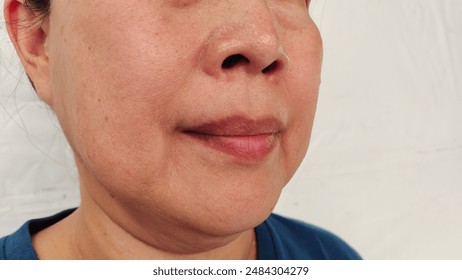 portrait the wrinkle and Flabby skin beside the mouth, smile lines and loose, swelling and ptosis under the eyes, dark spots and blemish, freckles and scar on the face, health care and beauty concept.