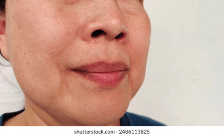 portrait the wrinkle and Flabby skin beside the mouth, smile lines and loose, swelling and ptosis under the eyes, dark spots and blemish, freckles and scar on the face, health care and beauty concept.