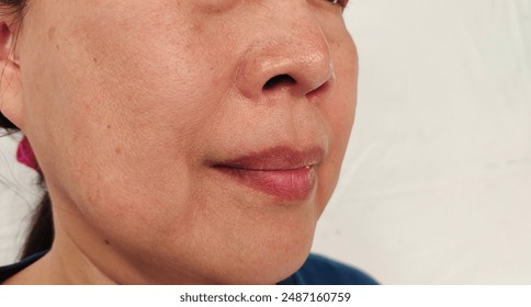 portrait the wrinkle and Flabby skin beside the mouth, smile lines and loose, swelling and ptosis under the eyes, dark spots and blemish, freckles and scar on the face, health care and beauty concept.