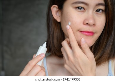 Portrait Of Young Asian Woman Holding Cosmetic Tube And Applying Acne Cream/moisturizer On Her Face For Treat Her Skin. Conceptual Of Beauty And Cosmetic.