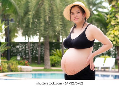 Portrait of a young beautiful asian pregnancy woman (30 weeks+) healthy and well being with stretch marks skin on her belly standing by the pool. Beautiful scar, Summer vocation, Expected, Swimming.