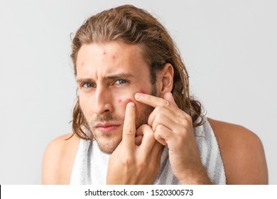 Portrait of young man with acne problem squishing pimples on light background