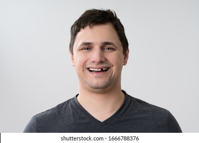 Portrait Of Young Man With Missing Tooth