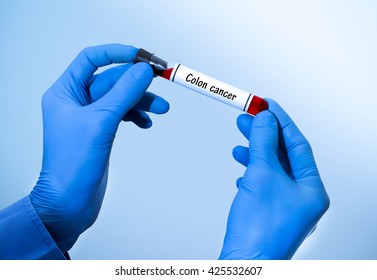 Positive result of blood test for colon cancer. Test tube with a blood test in the doctor's hands. Medical concept.