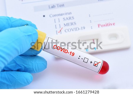 Positive test result by using rapid test device for COVID-19, novel coronavirus 2019 found in Wuhan, China