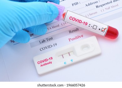 Positive Test Result Of COVID-19 Virus By Using Rapid Card Test Antibody Method