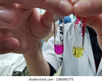 Positive Urease Test When The Color Of Yellow Reagent Turn Pink Demonstrated The Presence Of Helicobacter Pylori Infection.