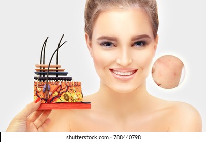 Post-Acne Marks /Treating Acne Scars