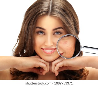 Post-Acne Marks /Treating Acne Scars.Acne Scar Removal