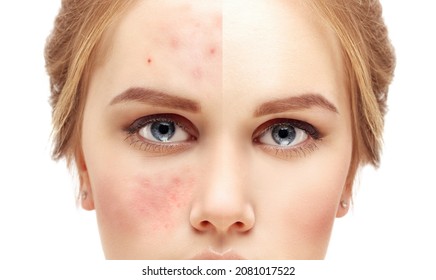 6,220 Scar mark Images, Stock Photos & Vectors | Shutterstock