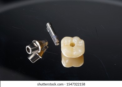 Posterior implant crown with custom abutment - Shutterstock ID 1547322158