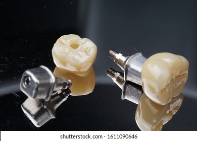 Posterior  implant crown with custom abutment - Shutterstock ID 1611090646